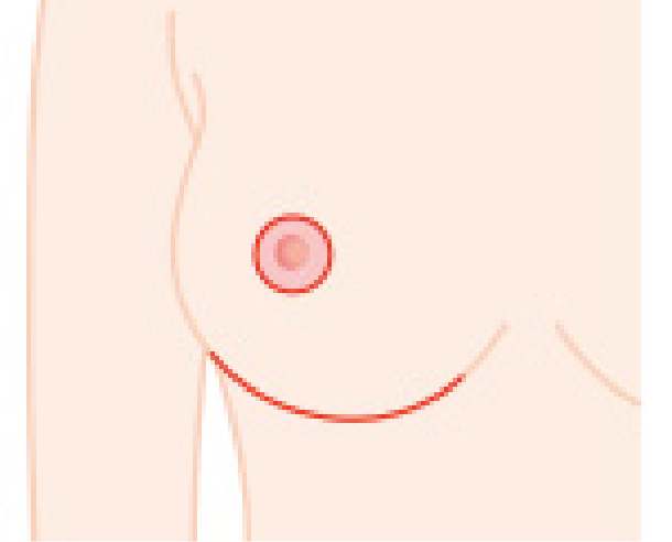 特別法 乳首をトンネルに潜らせるように上に移動させます（イラスト）