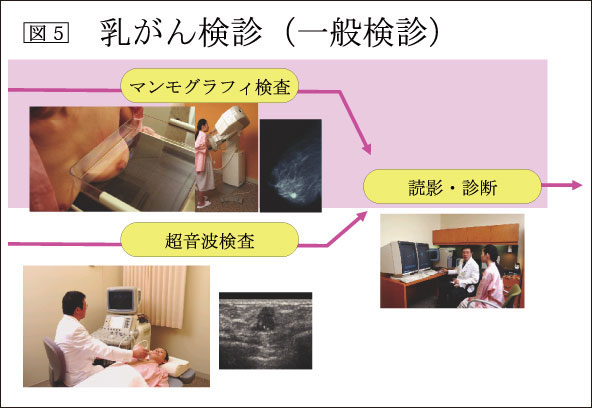 図5：乳がん検診（一般検診）