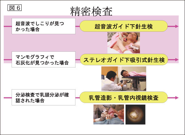 図6：精密検査